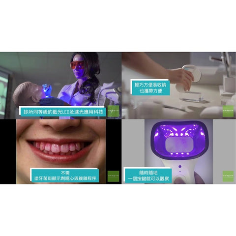 牙齒守護神 牙視儀 | I-Cute