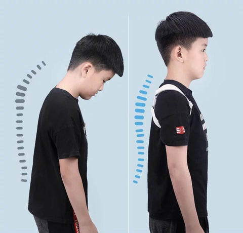智能駝背寒背矯正器 | Accion SuperBack